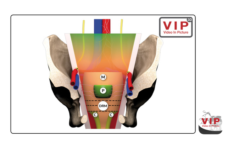 tekening buik inzicht