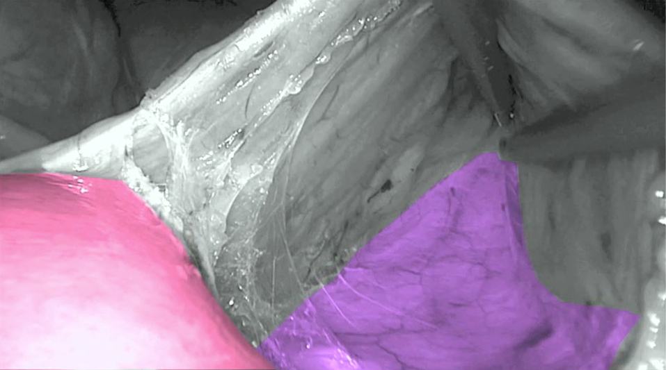 foto van tijdens de operatie