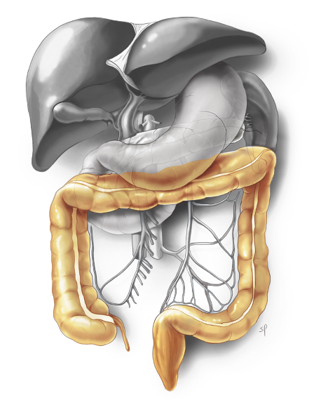 tekening colorectaal