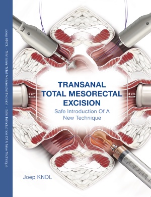 Kaft van doctoraatsthesis